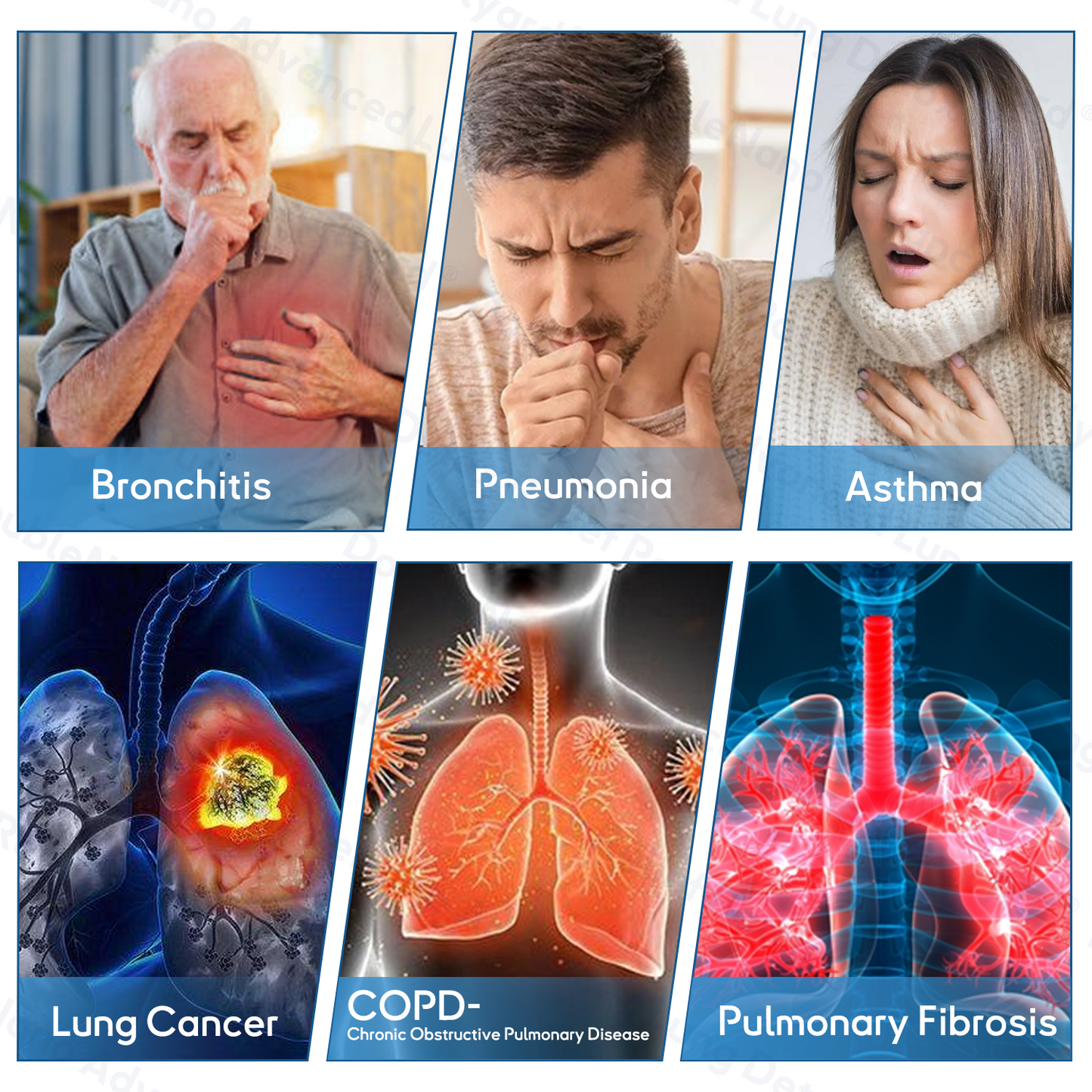 😽✨𝐎𝐟𝐟𝐢𝐜𝐢𝐚𝐥 𝐒𝐭𝐨𝐫𝐞:ClearLungX™ 𝐃𝐨𝐮𝐛𝐥𝐞𝐍𝐚𝐧𝐨 𝐀𝐝𝐯𝐚𝐧𝐜𝐞𝐝 𝐋𝐮𝐧𝐠 𝐃𝐞𝐭𝐨𝐱 𝐑𝐞𝐥𝐢𝐞𝐟 𝐏𝐚𝐭𝐜𝐡💝𝐅𝐃𝐀  𝐀𝐩𝐩𝐫𝐨𝐯𝐞𝐝